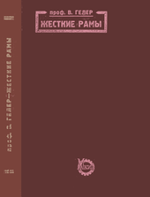 Жесткие рамы.